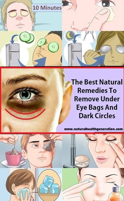 How to take care of tired eyes