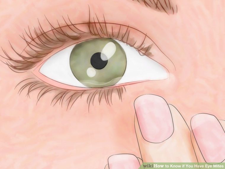 How to treat tired eyes