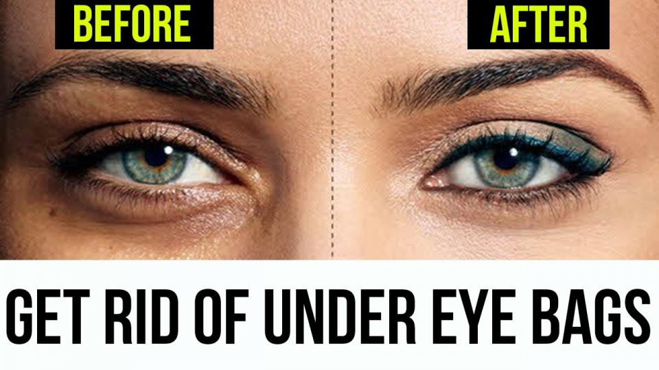 How to get rid of tired eyes fast