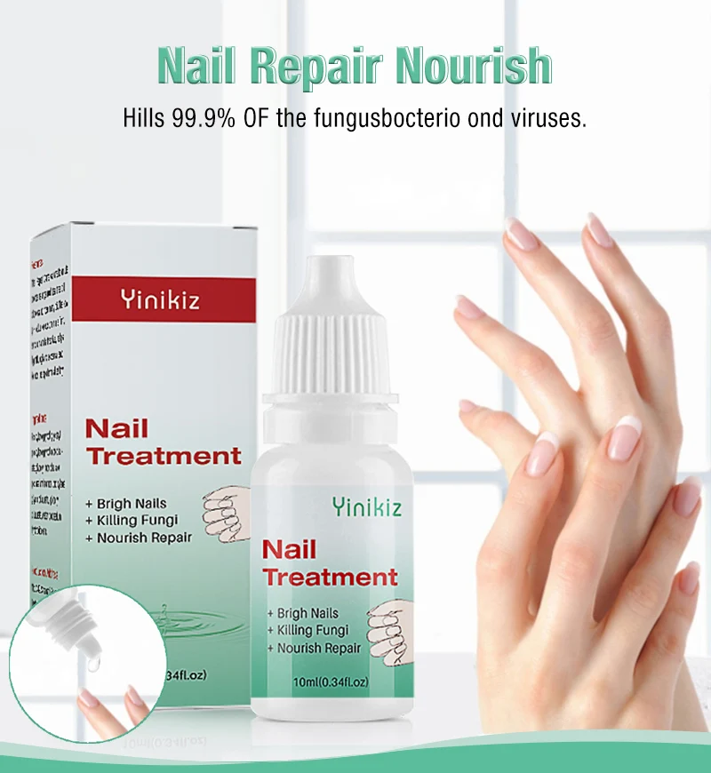 Nail repair kits